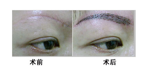 <a href=http://www.sbs17.com/listinfo-658-0.html target=_blank class=infotextkey>洗眉</a>后多久可以重新紋