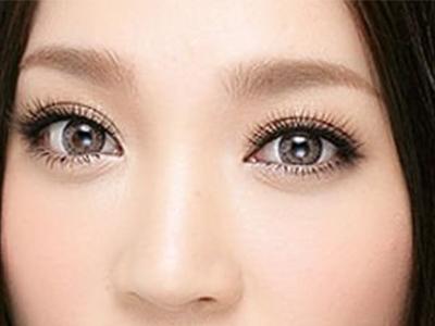 <a href=http://www.sbs17.com/listinfo-682-0.html target=_blank class=infotextkey>溶脂</a><a href=http://www.sbs17.com/listinfo-708-0.html target=_blank class=infotextkey>去眼袋</a>好不好呢