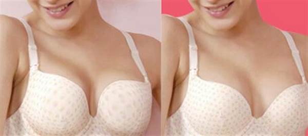 自體脂肪<a href=http://www.sbs17.com/listinfo-618-0.html target=_blank class=infotextkey>隆胸</a>多少錢