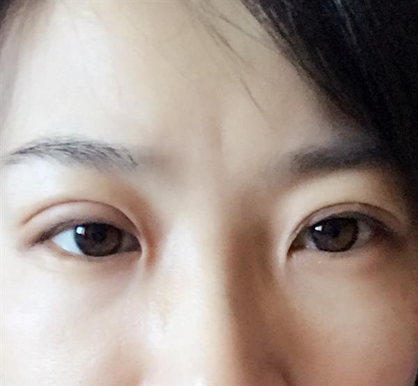 割了<a href=http://www.sbs17.com/listinfo-724-0.html target=_blank class=infotextkey>雙眼皮</a>多久能紋眉嗎