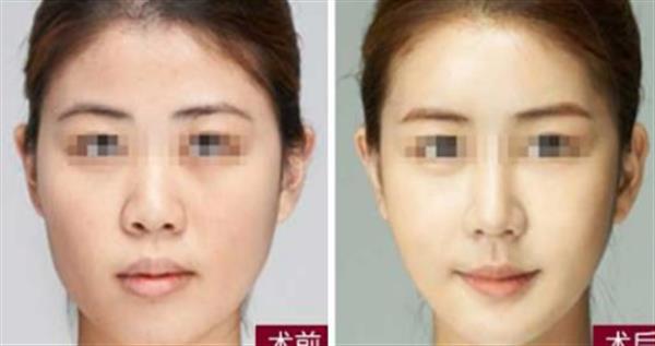 吃<a href=http://www.sbs17.com/listinfo-687-0.html target=_blank class=infotextkey>減肥</a>藥能打<a href=http://www.sbs17.com/listinfo-631-0.html target=_blank class=infotextkey>瘦臉</a><a href=http://www.sbs17.com/listinfo-614-0.html target=_blank class=infotextkey>除皺</a>嗎