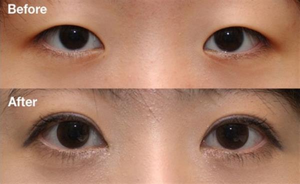 <a href=http://www.sbs17.com/listinfo-724-0.html target=_blank class=infotextkey>雙眼皮</a>加<a href=http://www.sbs17.com/listinfo-711-0.html target=_blank class=infotextkey>開眼角</a>多少錢