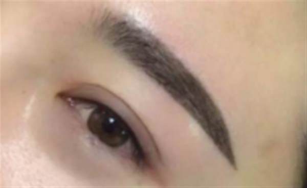 疤痕體質(zhì)可不可以紋眉呢