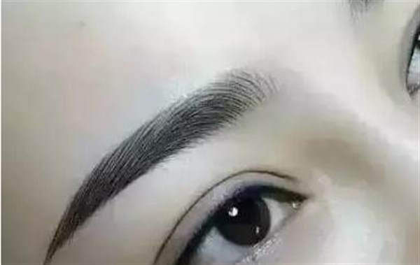 疤痕體質(zhì)紋眉有危害嗎