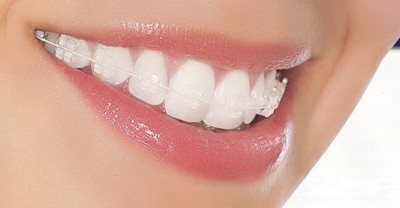 3d<a href=http://www.sbs17.com/listinfo-830-0.html target=_blank class=infotextkey>美容冠</a>多少錢
