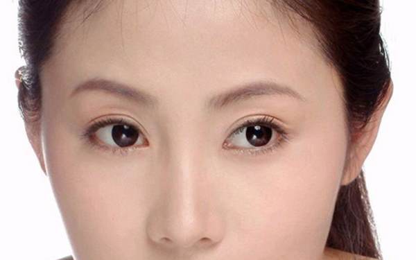 開內(nèi)眼角增生會(huì)好嗎