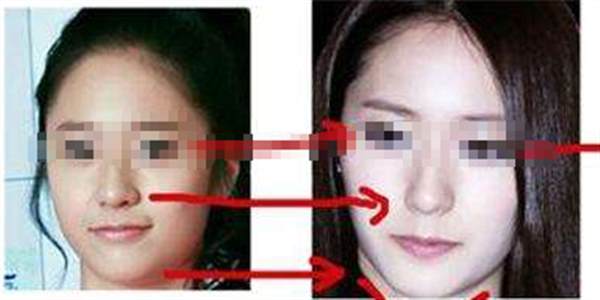 方形臉骨骼大怎么<a href=http://www.sbs17.com/listinfo-631-0.html target=_blank class=infotextkey>瘦臉</a>