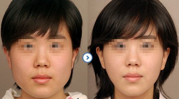 7個簡單有效的<a href=http://www.sbs17.com/listinfo-631-0.html target=_blank class=infotextkey>瘦臉</a>方法