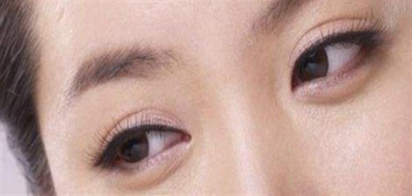 眼皮打透明質(zhì)酸可以打成<a href=http://www.sbs17.com/listinfo-724-0.html target=_blank class=infotextkey>雙眼皮</a>嗎