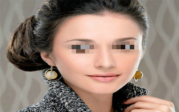 自體軟骨<a href=http://www.sbs17.com/listinfo-737-0.html target=_blank class=infotextkey>隆鼻</a>是長(zhǎng)期嗎？