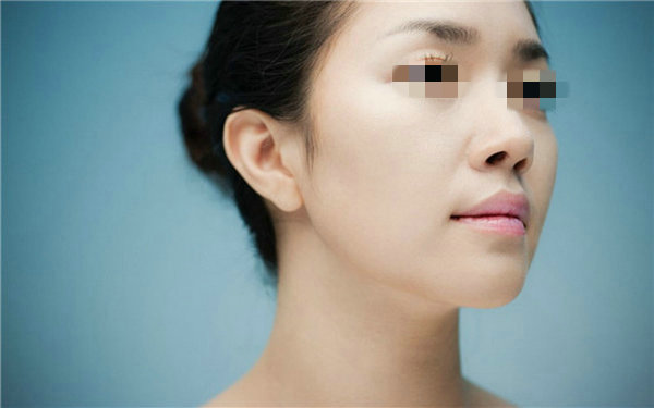 做假體<a href=http://www.sbs17.com/listinfo-737-0.html target=_blank class=infotextkey>隆鼻</a>手術(shù)多少錢(qián)？