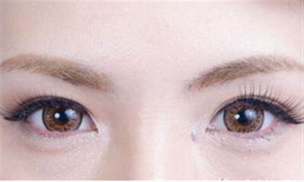 透明質(zhì)酸填充<a href=http://www.sbs17.com/listinfo-722-0.html target=_blank class=infotextkey>臥蠶</a>多少錢