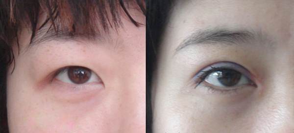 <a href=http://www.sbs17.com/listinfo-711-0.html target=_blank class=infotextkey>開眼角</a>有什么后遺癥嗎