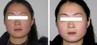 彩光<a href=http://www.sbs17.com/listinfo-763-0.html target=_blank class=infotextkey><a href=http://www.sbs17.com/listinfo-770-0.html target=_blank class=infotextkey>嫩膚</a>美白</a>的原理是什么
