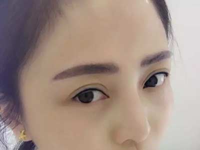 <a href=http://www.sbs17.com/listinfo-714-0.html target=_blank class=infotextkey>紋眼線</a>眼睛一般腫幾天