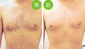 <a href=http://www.sbs17.com/listinfo-670-0.html target=_blank class=infotextkey>脫毛</a>到底哪種方法好