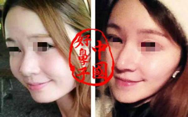 做膨體<a href=http://www.sbs17.com/listinfo-737-0.html target=_blank class=infotextkey>隆鼻</a>手術(shù)多少錢？