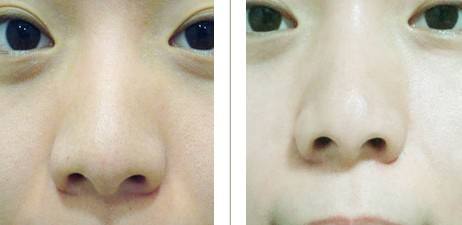 做彩光<a href=http://www.sbs17.com/listinfo-770-0.html target=_blank class=infotextkey>嫩膚</a>要多少錢