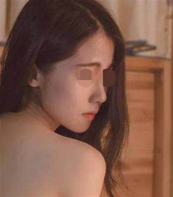 <a href=http://www.sbs17.com/listinfo-629-0.html target=_blank class=infotextkey>下頜角</a>整形手術(shù)術(shù)后如何護(hù)理