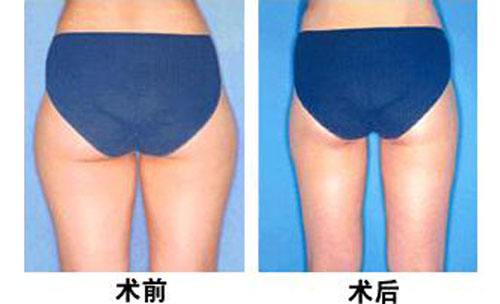 男生<a href=http://www.sbs17.com/listinfo-683-0.html target=_blank class=infotextkey>瘦臀</a>的快方法