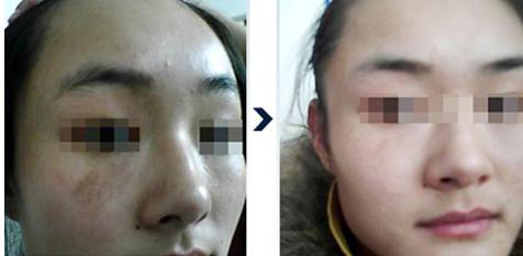 <a href=http://www.sbs17.com/listinfo-795-0.html target=_blank class=infotextkey>祛斑</a>較好的方法
