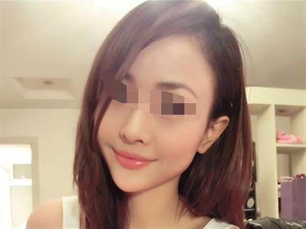 <a href=http://www.sbs17.com/listinfo-629-0.html target=_blank class=infotextkey>下頜角</a>切除手術(shù)的價格和優(yōu)點有哪些