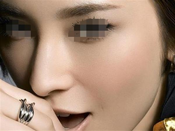 打透明質(zhì)酸<a href=http://www.sbs17.com/listinfo-737-0.html target=_blank class=infotextkey>隆鼻</a>能維持多久