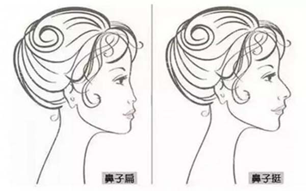 假體<a href=http://www.sbs17.com/listinfo-737-0.html target=_blank class=infotextkey>隆鼻</a>術的四個誤區(qū)有哪些？