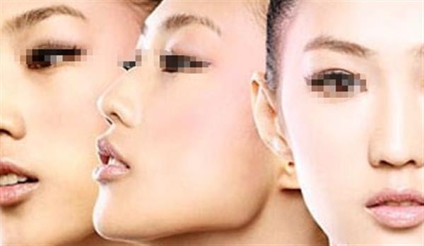 哪些人不適合進行光子<a href=http://www.sbs17.com/listinfo-770-0.html target=_blank class=infotextkey>嫩膚</a>