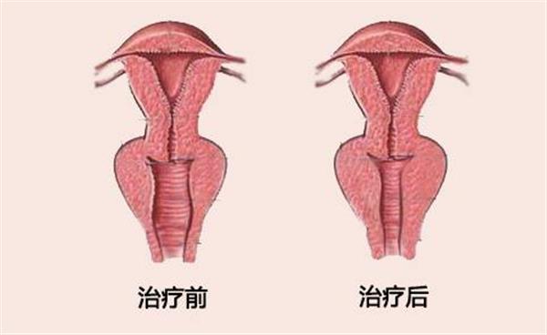 縮陰手術(shù)的價(jià)格