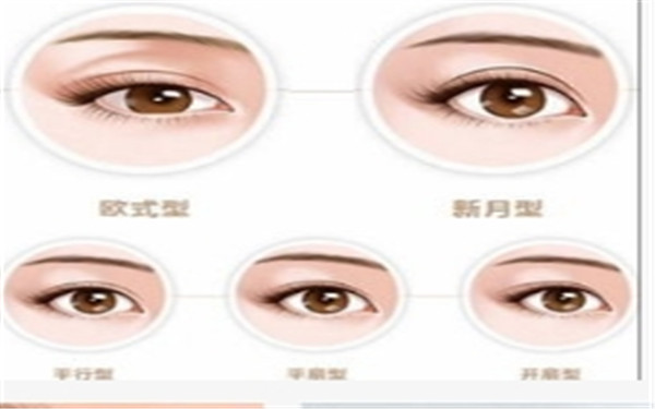  <a href=http://www.sbs17.com/listinfo-724-0.html target=_blank class=infotextkey>雙眼皮</a>修復有哪些原則