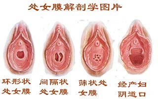 做<a href=http://www.sbs17.com/listinfo-800-0.html target=_blank class=infotextkey>私密整形</a>手術(shù)多少錢(qián)?