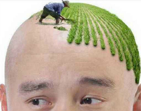 植發(fā)后幾天毛囊穩(wěn)固了