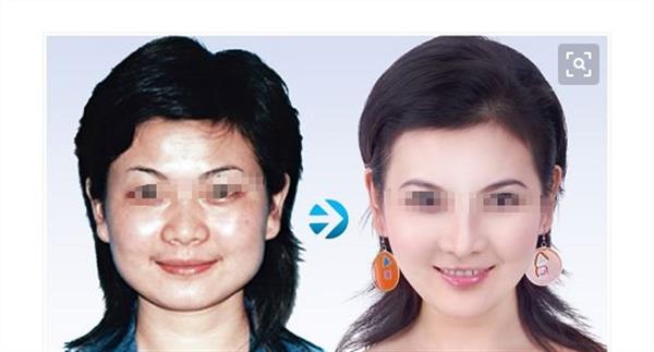 彩光<a href=http://www.sbs17.com/listinfo-770-0.html target=_blank class=infotextkey>嫩膚</a>手術(shù)的優(yōu)點有哪些呢