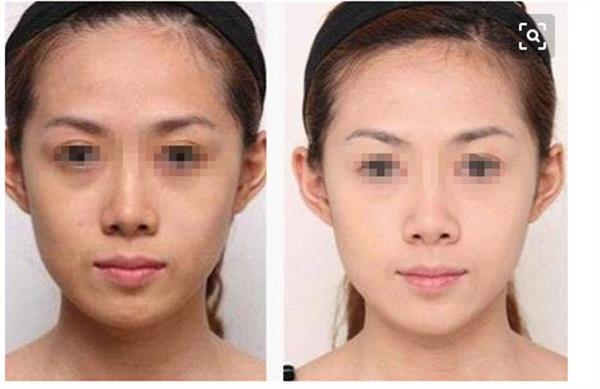 彩光<a href=http://www.sbs17.com/listinfo-763-0.html target=_blank class=infotextkey><a href=http://www.sbs17.com/listinfo-770-0.html target=_blank class=infotextkey>嫩膚</a>美白</a>后要如何護(hù)理