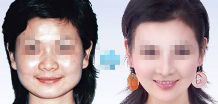 光子<a href=http://www.sbs17.com/listinfo-770-0.html target=_blank class=infotextkey>嫩膚</a>的危害、缺陷
