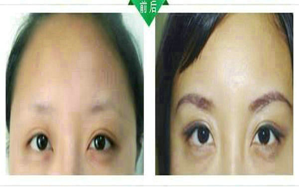 <a href=http://www.sbs17.com/listinfo-655-0.html target=_blank class=infotextkey>切眉</a>多久可以<a href=http://www.sbs17.com/listinfo-657-0.html target=_blank class=infotextkey>繡眉</a>?