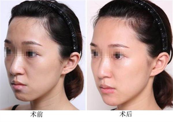 哪些人不適合做光子<a href=http://www.sbs17.com/listinfo-770-0.html target=_blank class=infotextkey>嫩膚</a>呢