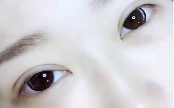 杭州單眼皮做<a href=http://www.sbs17.com/listinfo-724-0.html target=_blank class=infotextkey>雙眼皮</a>價格