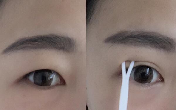 貼<a href=http://www.sbs17.com/listinfo-724-0.html target=_blank class=infotextkey>雙眼皮</a>貼眼皮松弛怎么辦