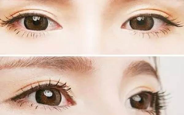 杭州眼部<a href=http://www.sbs17.com/listinfo-4-0.html target=_blank class=infotextkey>整形醫(yī)院</a>哪兒好