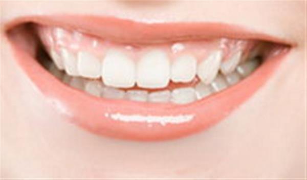 <a href=http://www.sbs17.com/listinfo-825-0.html target=_blank class=infotextkey>牙齒種植</a>與假牙的區(qū)別