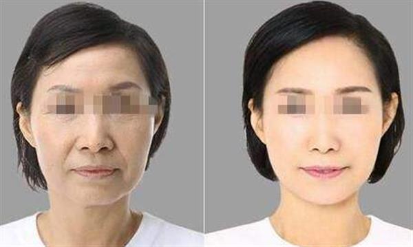彩光<a href=http://www.sbs17.com/listinfo-770-0.html target=_blank class=infotextkey>嫩膚</a>手術有哪些功效呢