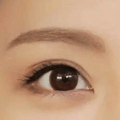 睫毛移植術(shù)效果持續(xù)時(shí)間