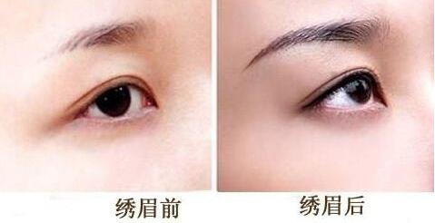 眉部美容<a href=http://www.sbs17.com/listinfo-657-0.html target=_blank class=infotextkey>繡眉</a>大概需要多少錢(qián)