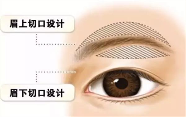 提眉和<a href=http://www.sbs17.com/listinfo-655-0.html target=_blank class=infotextkey>切眉</a>的區(qū)別