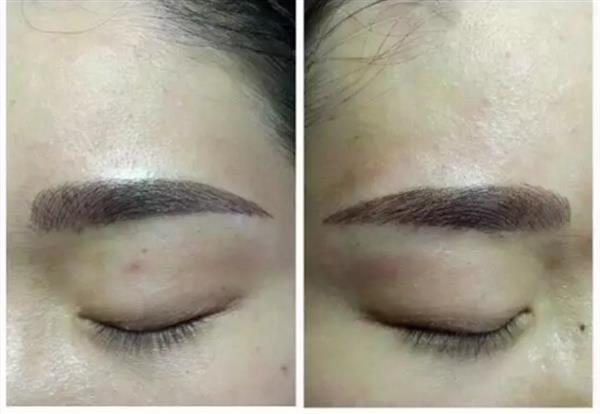 適合眉毛整形手術(shù)的有那些人群
