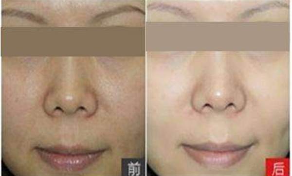 彩光<a href=http://www.sbs17.com/listinfo-770-0.html target=_blank class=infotextkey>嫩膚</a>美容有哪些好處