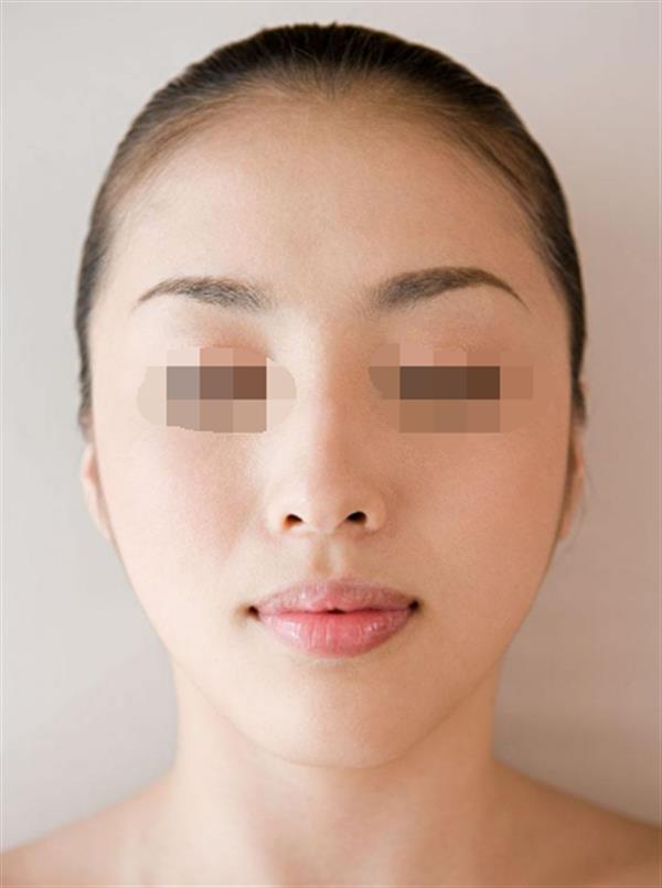 做完彩光<a href=http://www.sbs17.com/listinfo-770-0.html target=_blank class=infotextkey>嫩膚</a>后會(huì)不會(huì)反彈呢