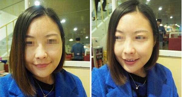 哪些人群不適合做光子<a href=http://www.sbs17.com/listinfo-770-0.html target=_blank class=infotextkey>嫩膚</a>呢